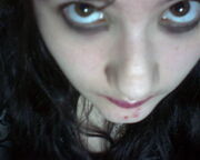 Me with chin-zits...blah