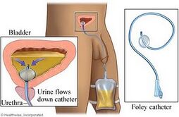 Infecção urinária 4