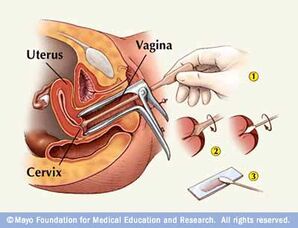 C C Utero7