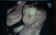 305-Adalind's ultrasound
