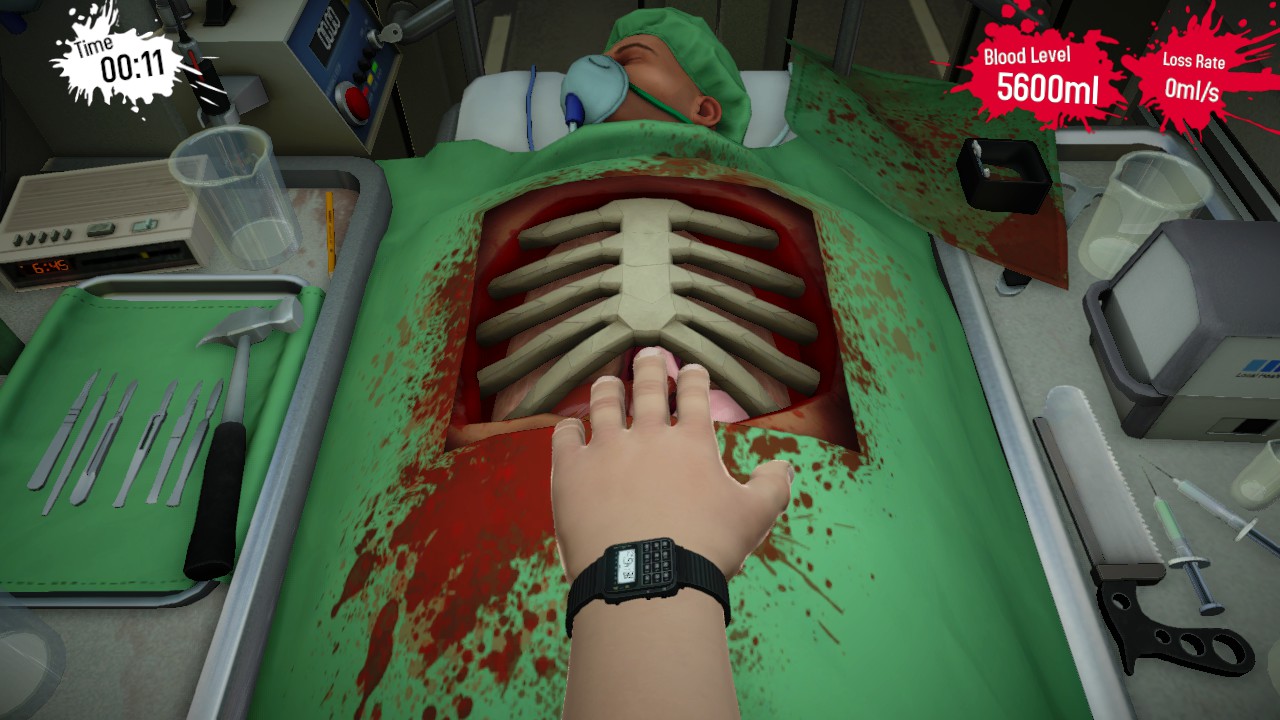 double kidney transplant surgeon simulator where to cut